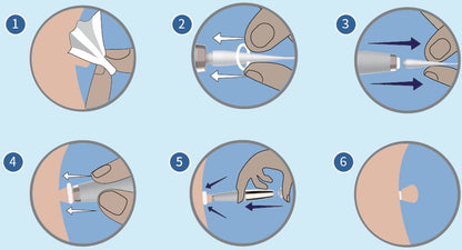 Rapid Tag Removal Kit